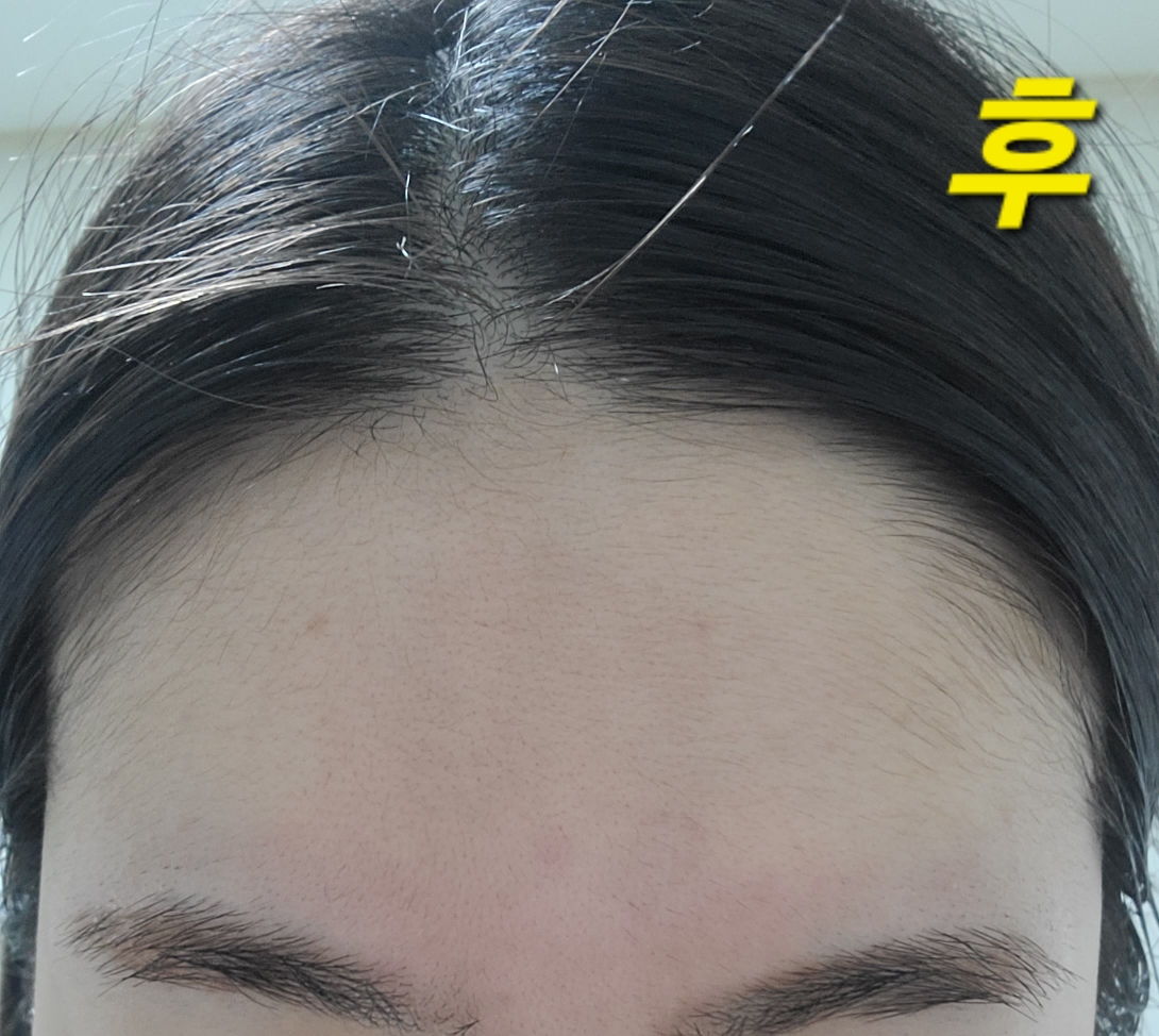 프롬리에 (fromrier) 비건 어성초 히알 카밍 배리어 앰플 review image