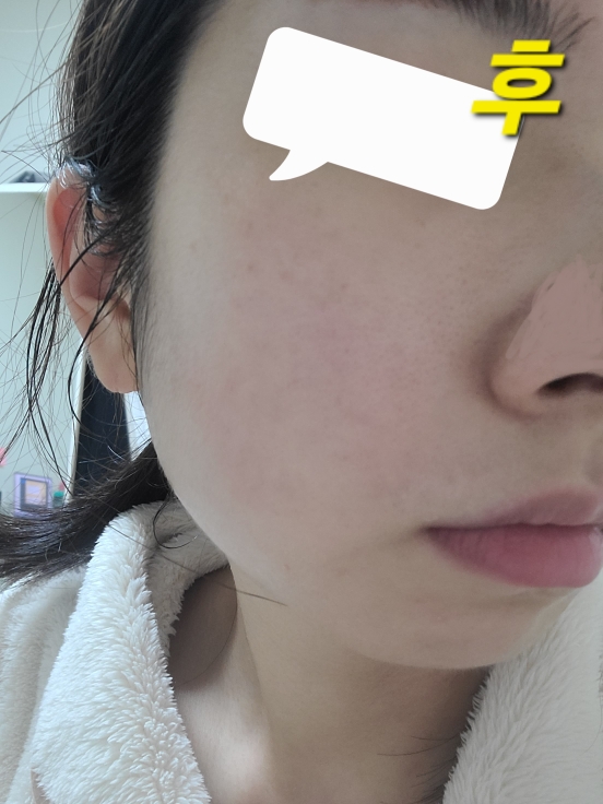프롬리에 (fromrier) 비건 어성초 히알 카밍 배리어 앰플 review image