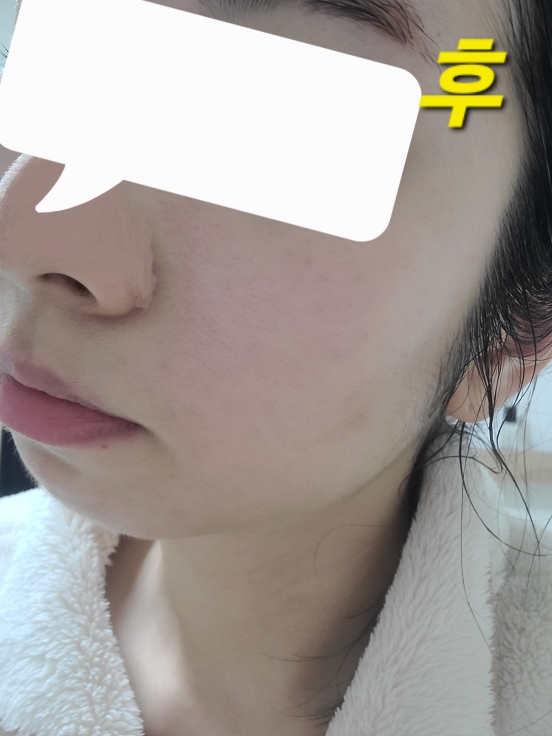 프롬리에 (fromrier) 비건 어성초 히알 카밍 배리어 앰플 review image