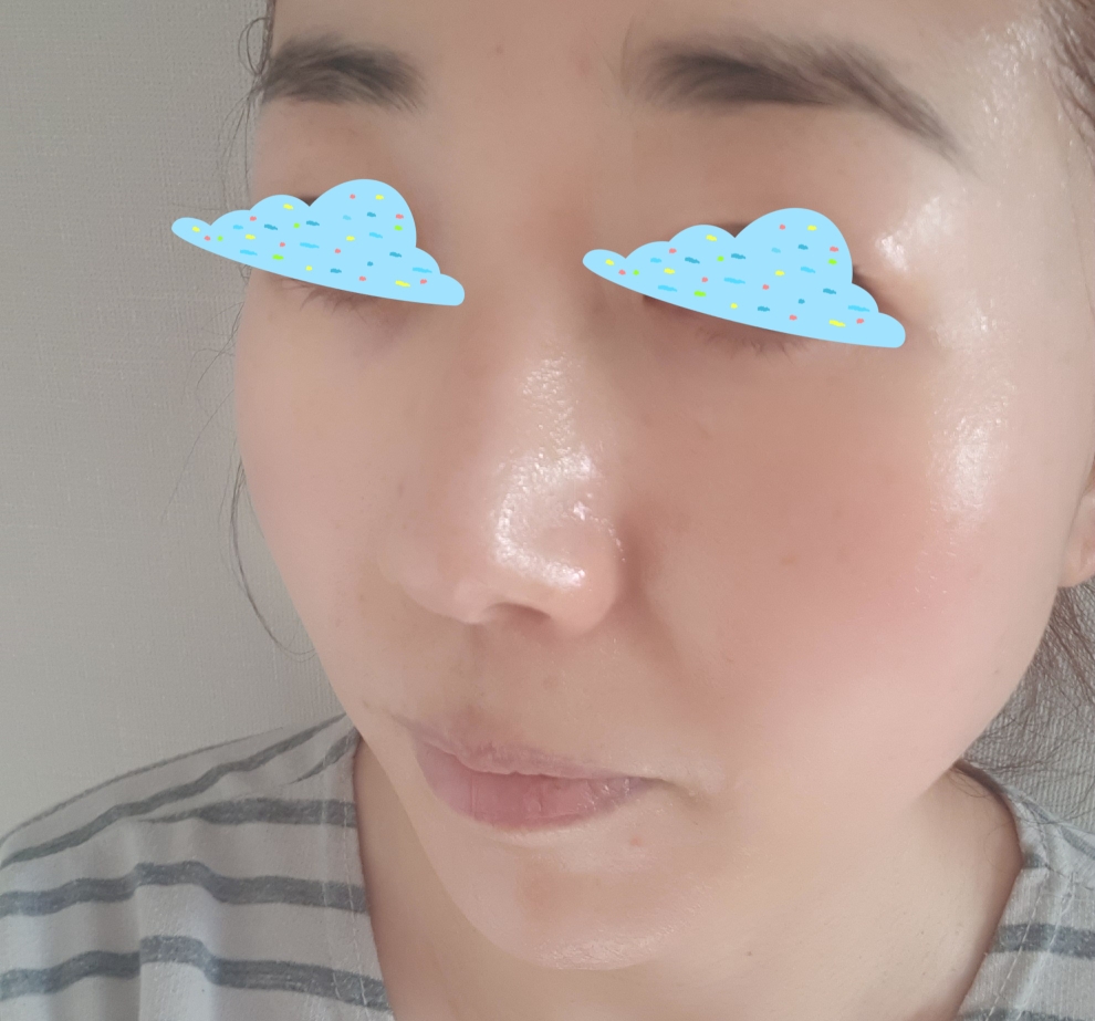 悦木之源三步美白面膜大包装的真实用户使用照片