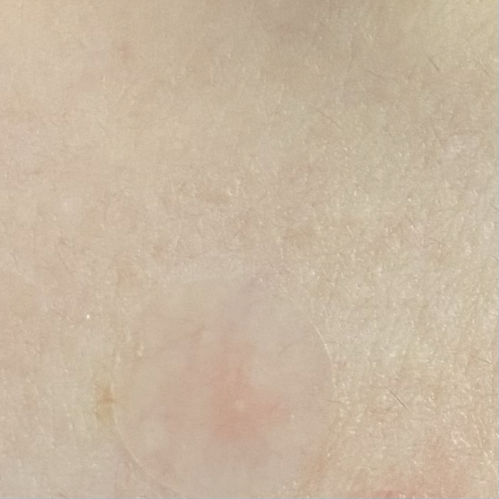 바이오디티디 (byeod-td) 스팟 카밍 패치 review image