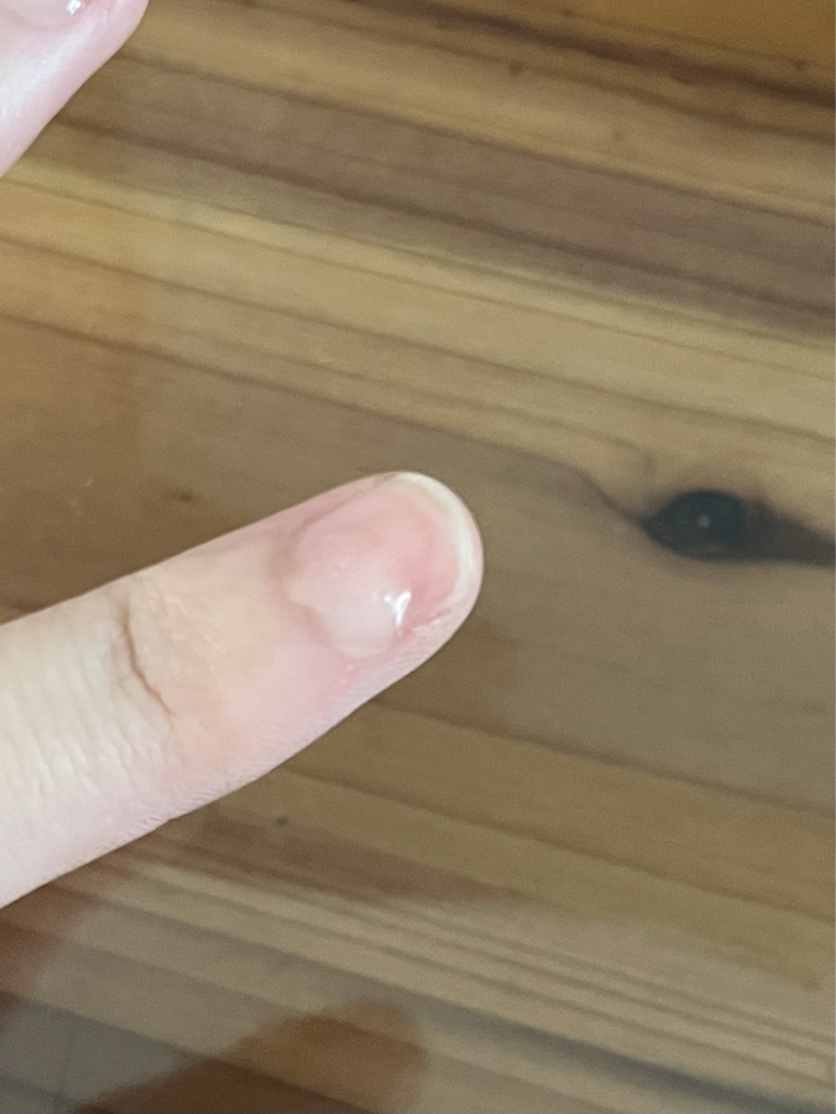 넛세린 (nutseline) 슈퍼 넛 너리싱 네일 케어 세럼 review image