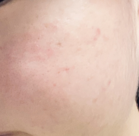OHIOHOO Apple Toktok Toner review image