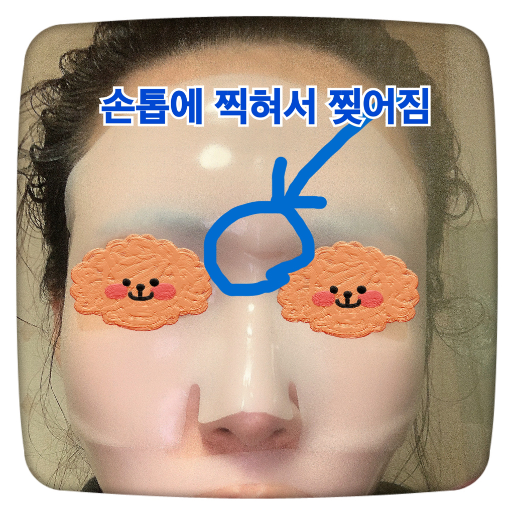 真实肌肤贴合胶原蛋白面膜的真实用户使用照片