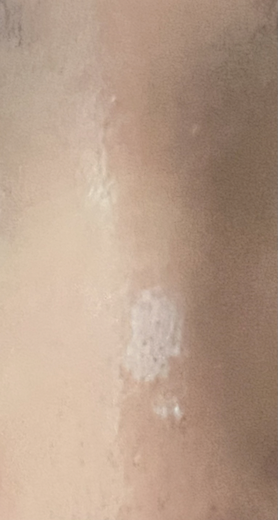 活力烟酰胺 20% 精华素的真实用户使用照片
