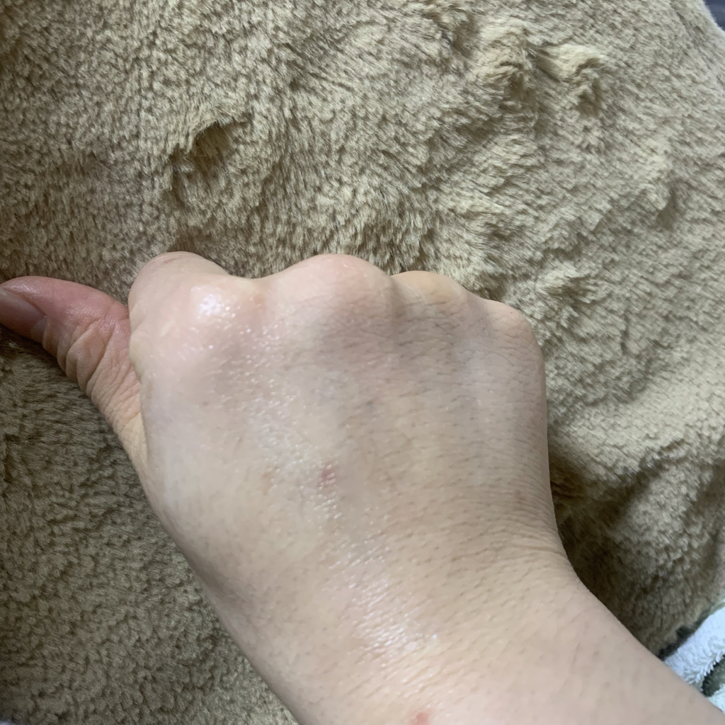 Real user review photo of Even Better Clinical Dark Spot Corrector