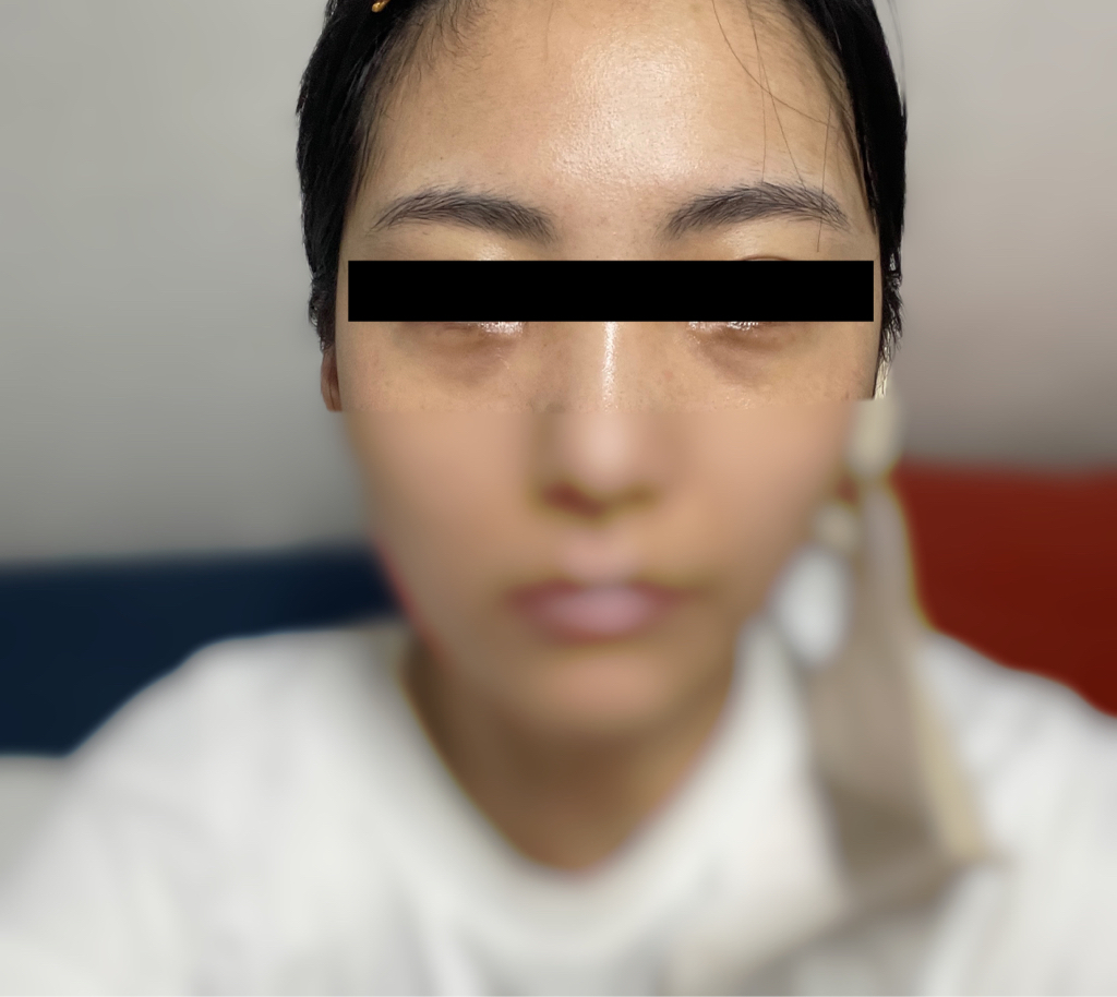 I·LENOL 艾瑞诺尔视黄醇眼霜 common.review image