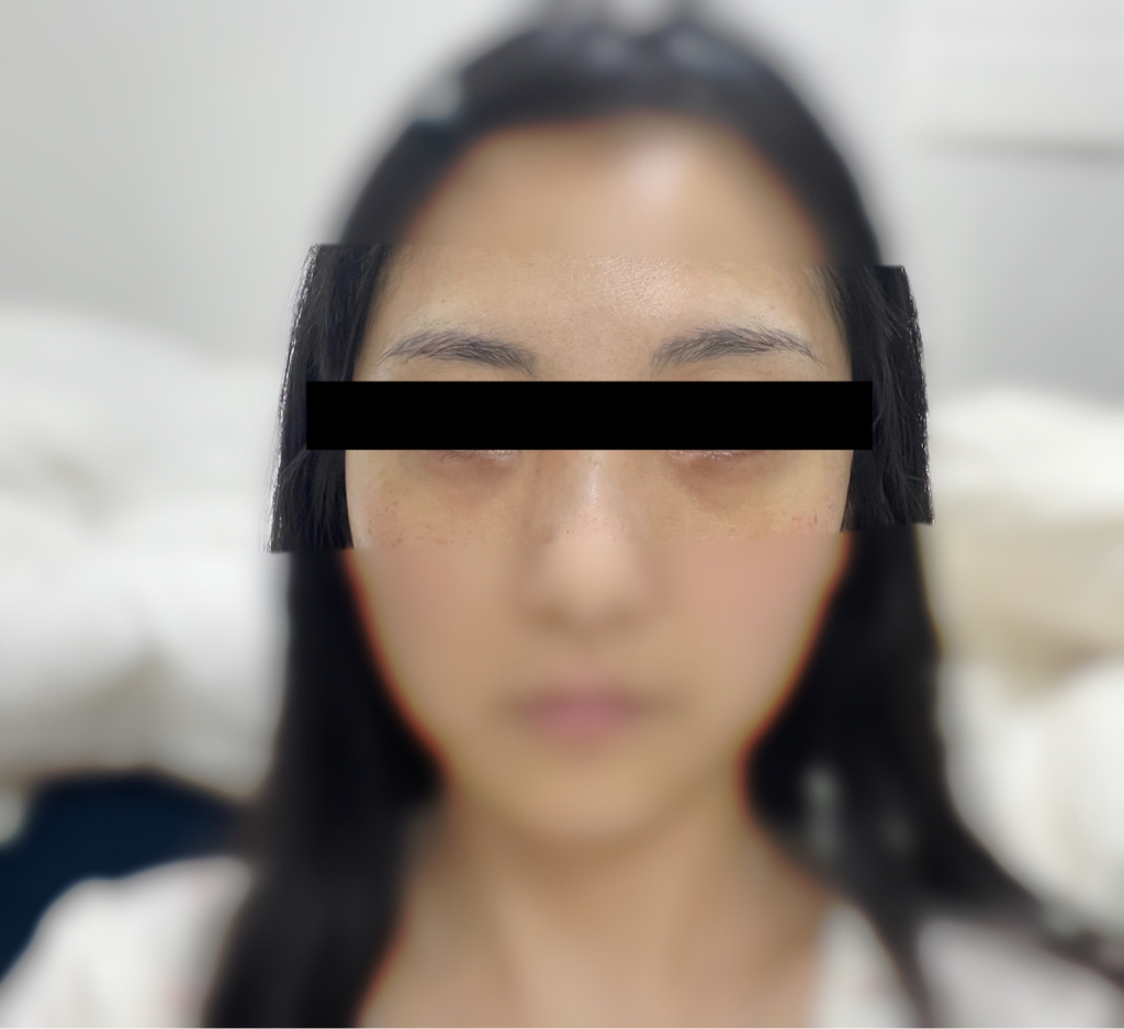 I·LENOL 艾瑞诺尔视黄醇眼霜 common.review image