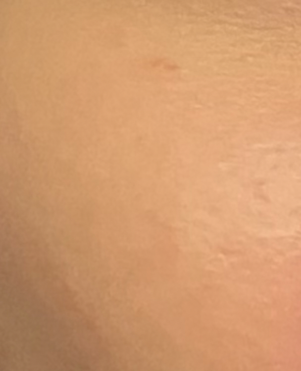 에스테프로 (esthepro) 글루타티온 앰플 551 review image