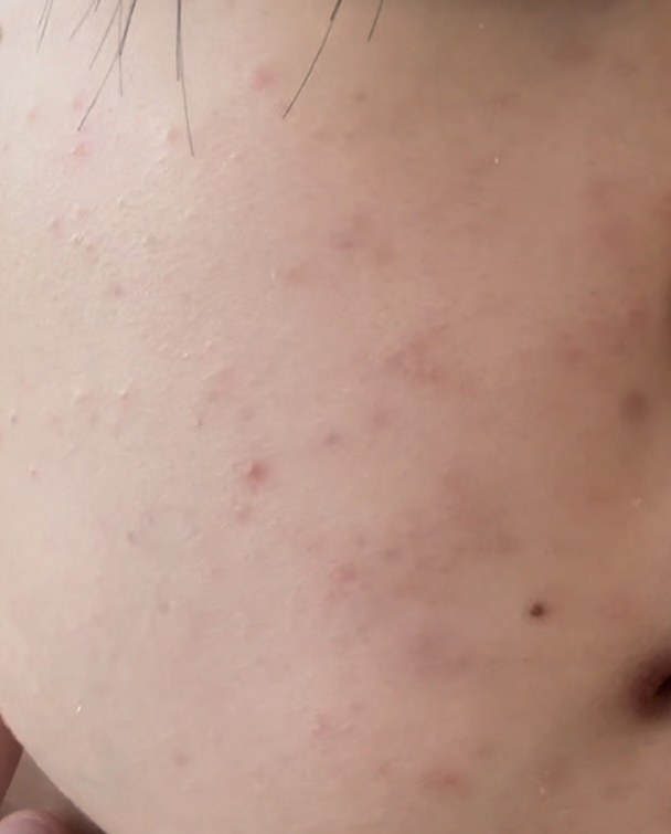 复活草睡眠面霜的真实用户使用照片