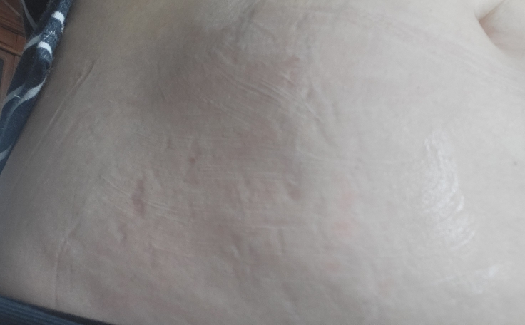 아토팜 STRETCH MARK CREAM review image