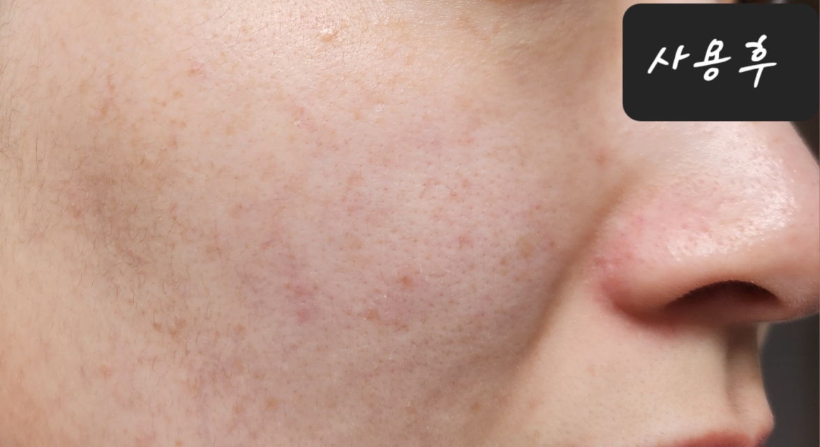 비오템옴므 (BIOTHERMHOMME) 포스 수프림 클렌저 review image