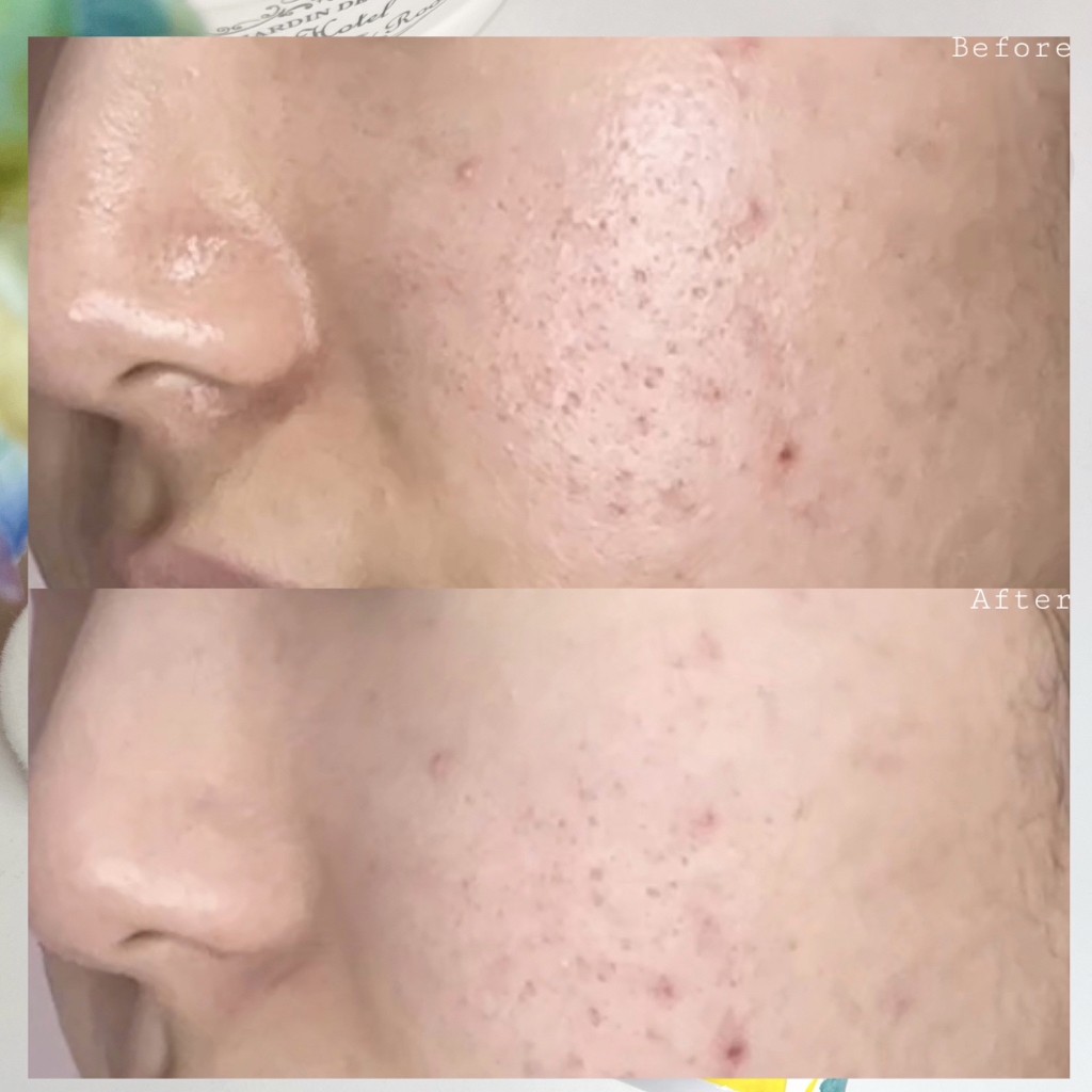 product review image