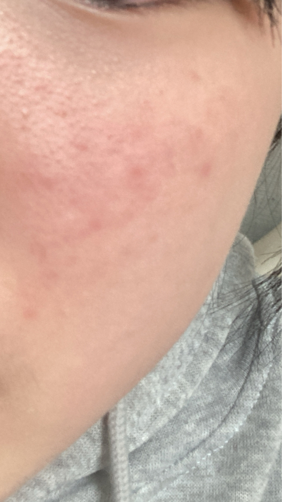 맥스클리닉 (MAXCLINIC) 타임 리턴 멜라토닌 쿠션 [SPF50+/PA++++] [21호 아이보리] review image