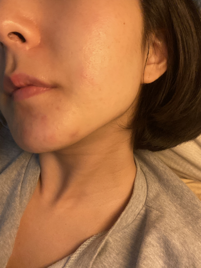 Elixir 蜂胶精华液的真实用户使用照片