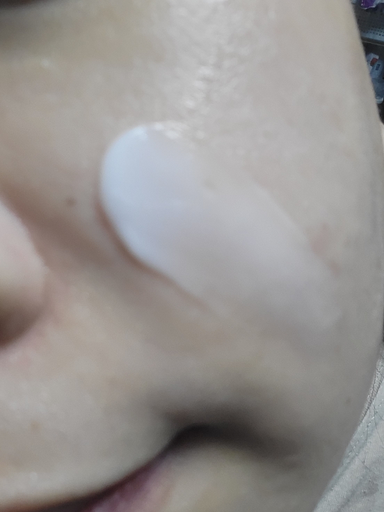 阿托佩龙修复霜的真实用户使用照片