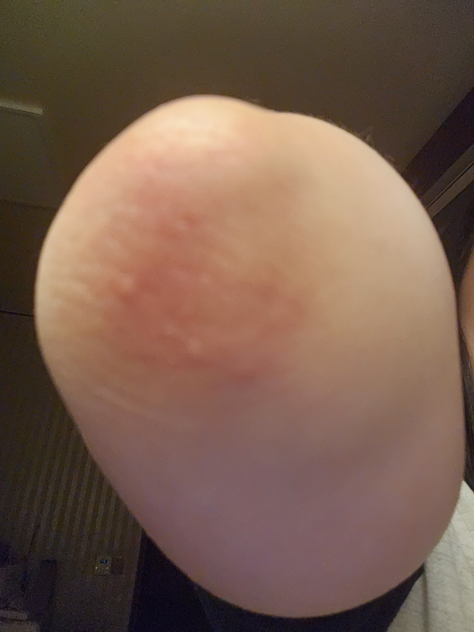 Derma Healer 保湿霜的真实用户使用照片