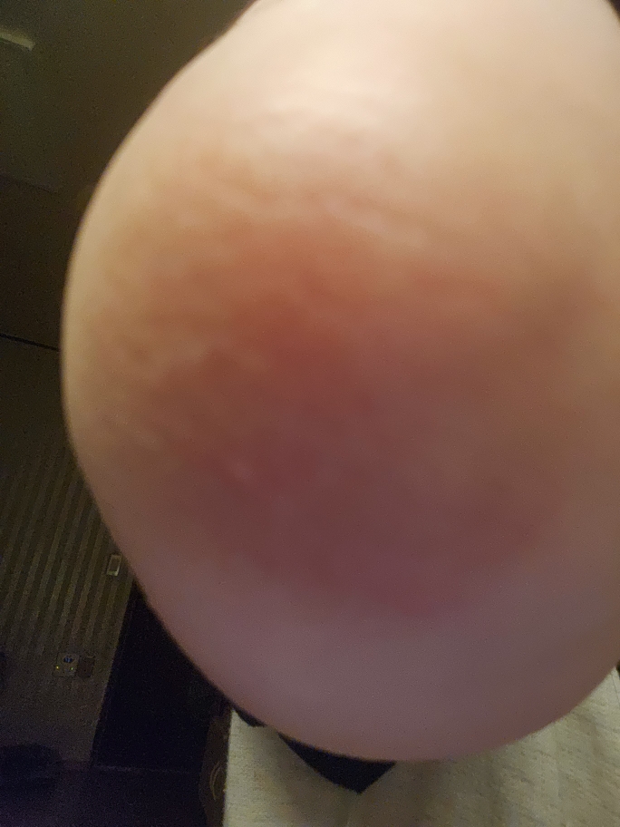 Derma Healer 保湿霜的真实用户使用照片