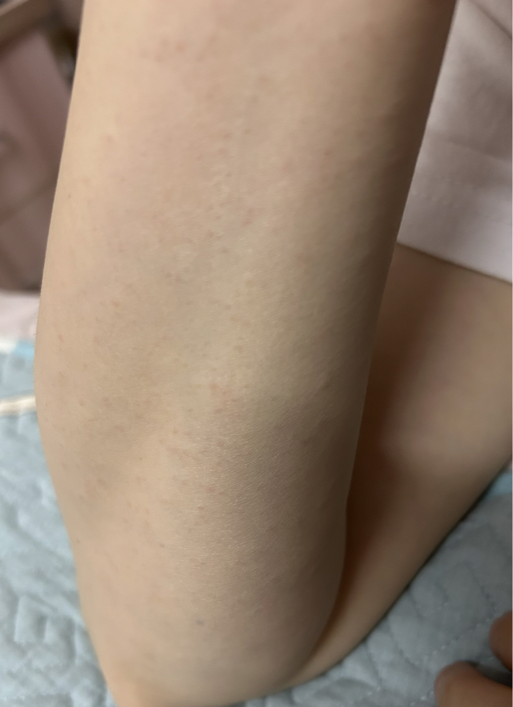 皱纹弹性精华防晒霜 [SPF50+/PA++++]的真实用户使用照片