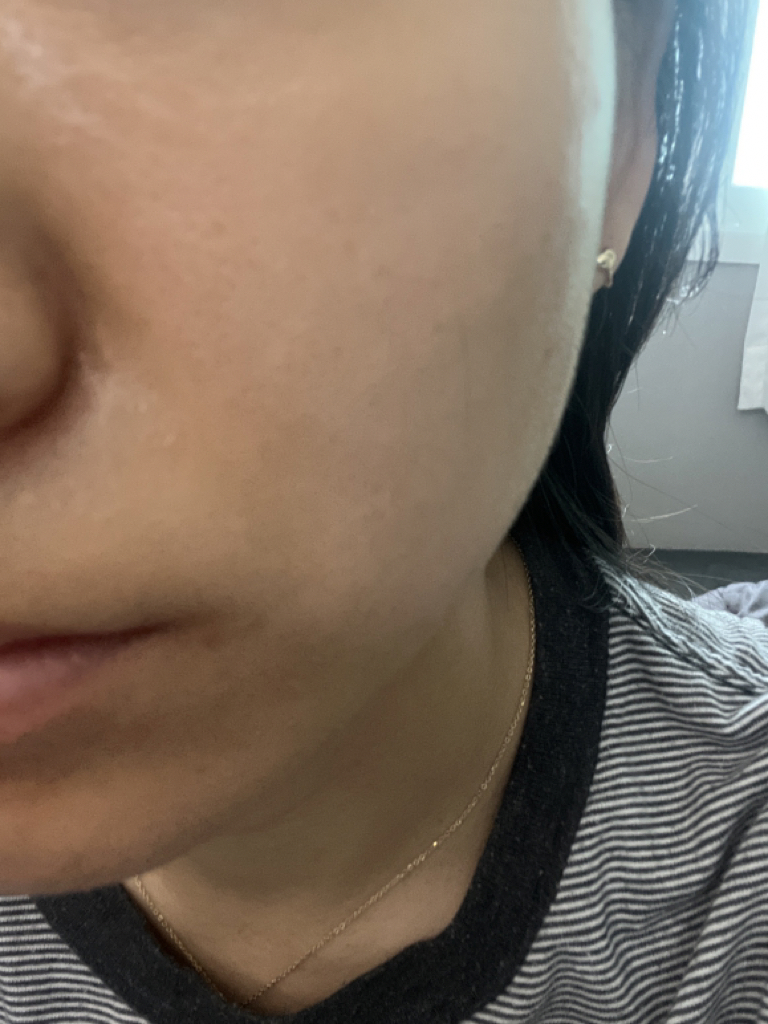 Elixir 蜂胶精华液的真实用户使用照片