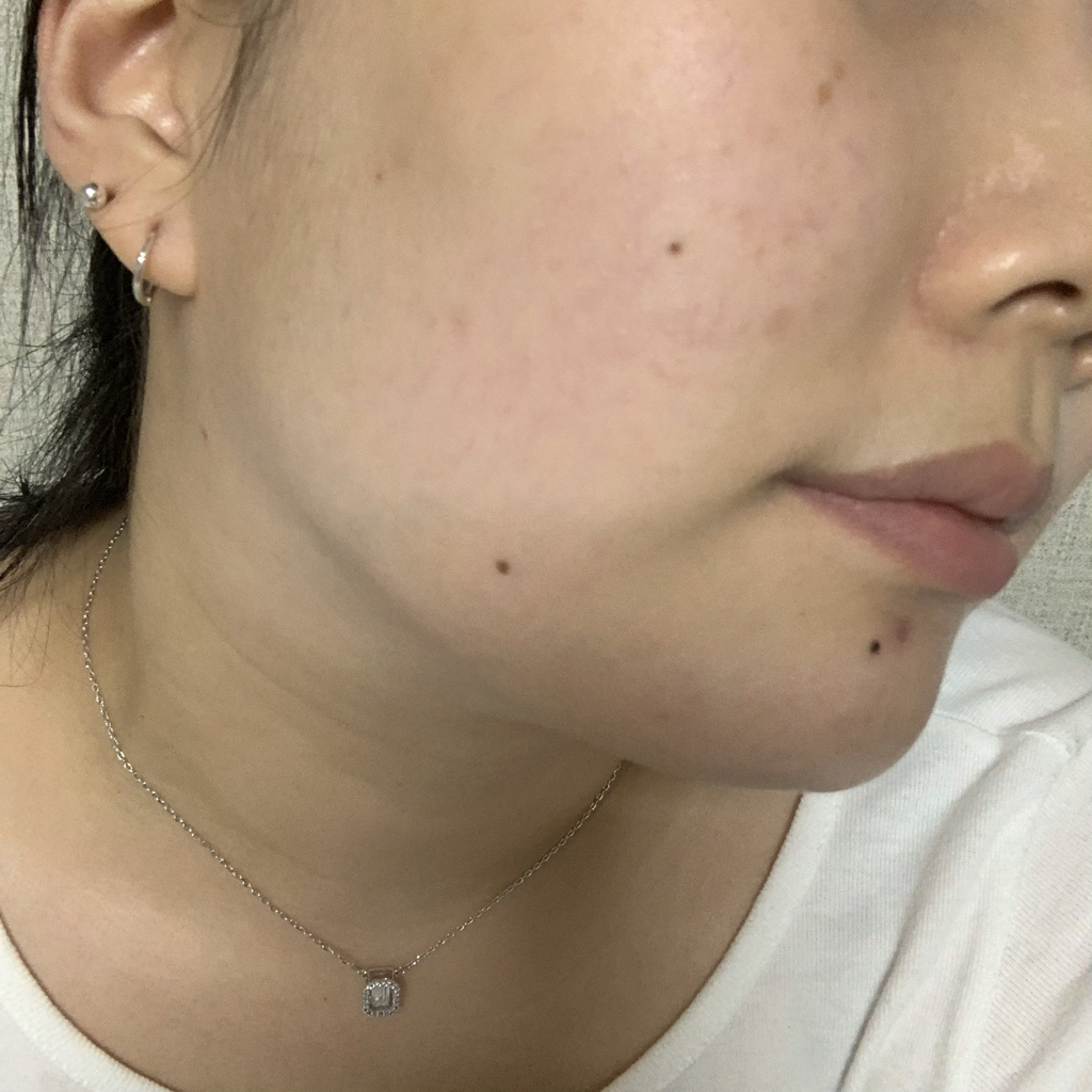 피에이치하비 (Ph.Hubby) 씀바귀 진정 토너 review image