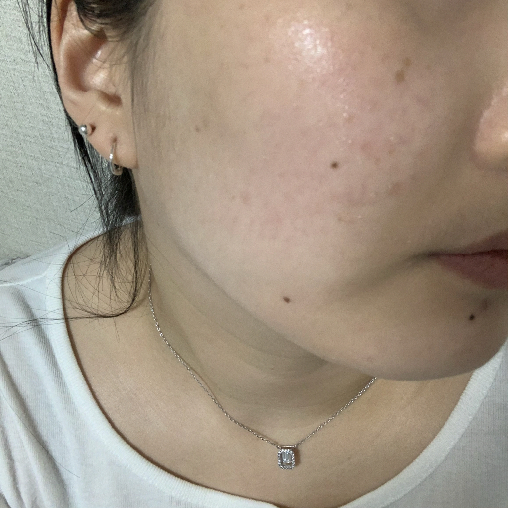 피에이치하비 (Ph.Hubby) 씀바귀 진정 토너 review image