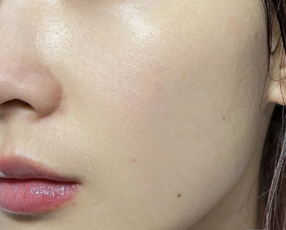 斐得药芳 阿克奈洗液 23 安瓿 common.review image