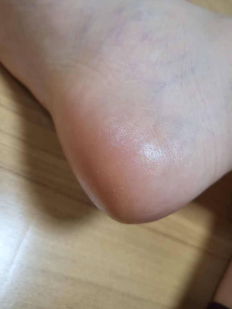 성분에디터 (SUNGBOONeditor) 시어버터 아기발 스틱 review image