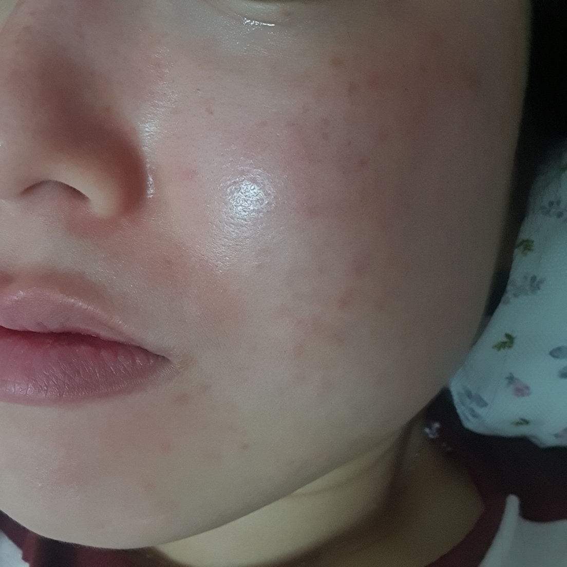 브리 (Breey) 아줄렌 트러블 스팟 에센스 review image