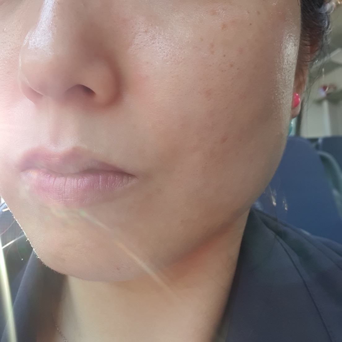 브리 (Breey) 아줄렌 트러블 스팟 에센스 review image
