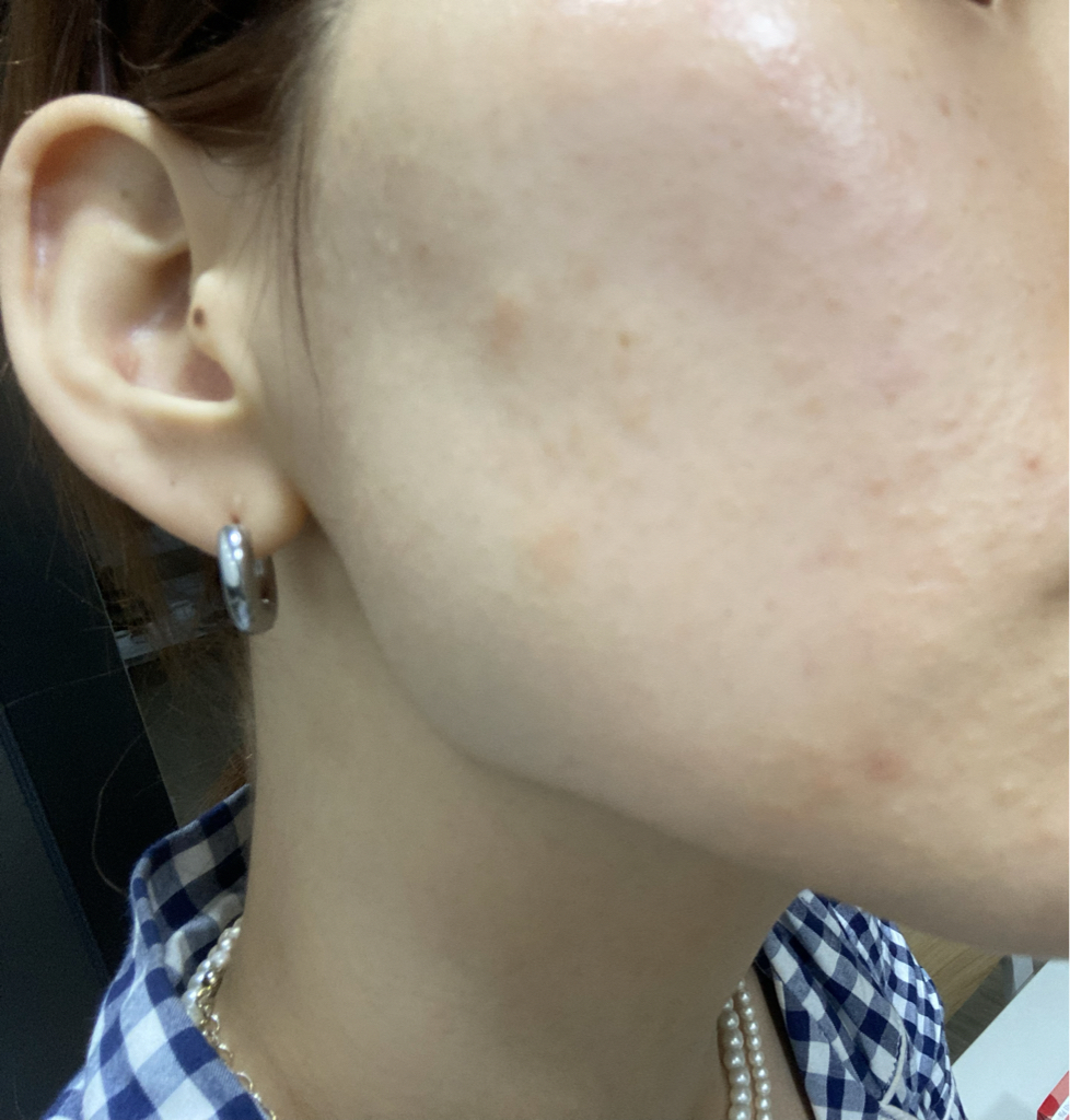 Real user review photo of NUDE GEL MASK [TEATREE]