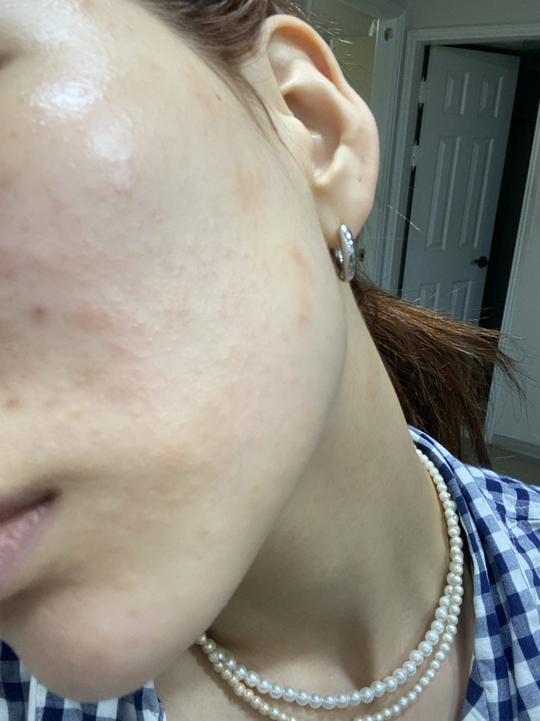 Real user review photo of NUDE GEL MASK [TEATREE]