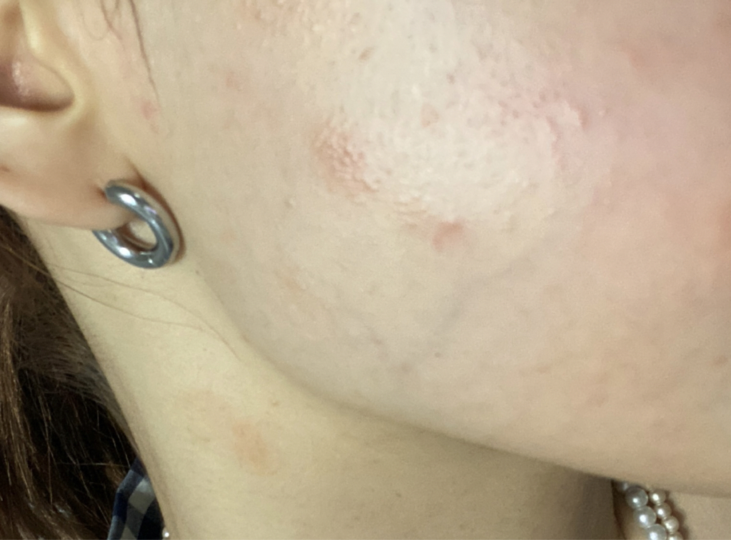 Real user review photo of NUDE GEL MASK [TEATREE]