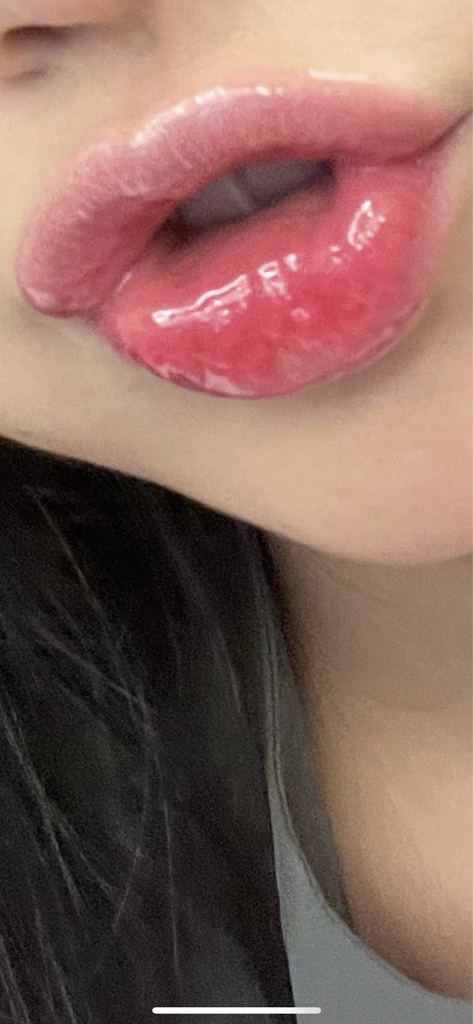 润唇膏的真实用户使用照片