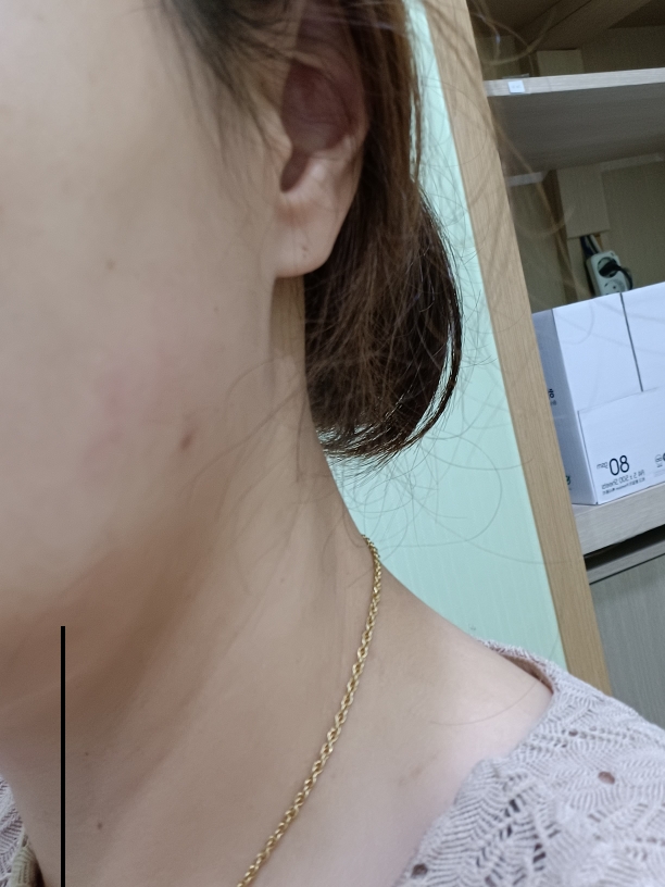 리프비기닝 (LeafBeginning) 아크밀리 시카 스팟 젤 review image