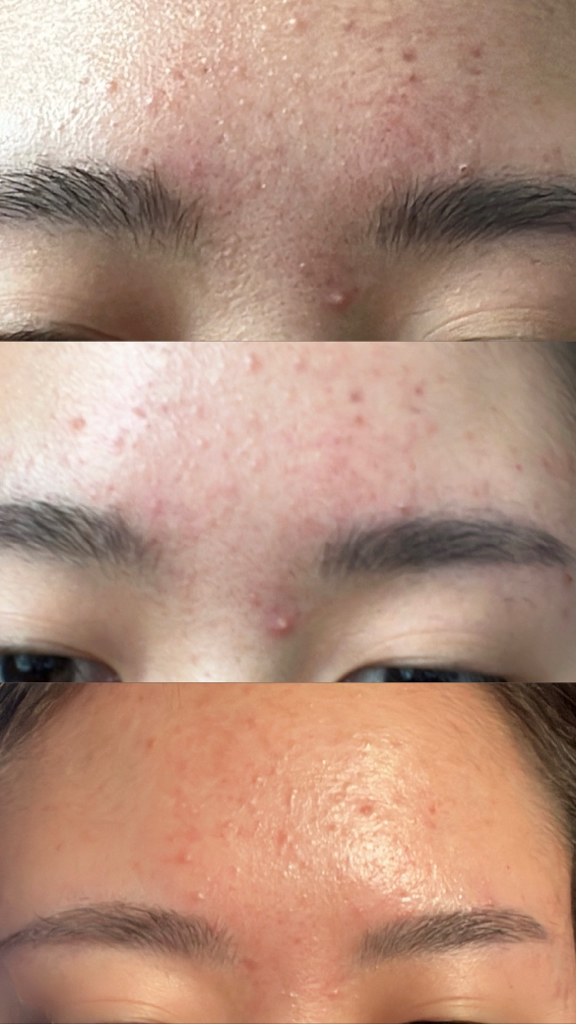 PercentScience 德克西诺-16.3血清 common.review image
