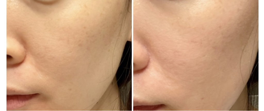 Real user review photo of Spring tone up Sun cream [SPF50+/PA++++]