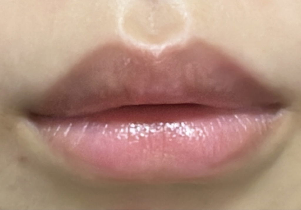 립리프 (Liplief) 스티밍 립밤 [얼라이브] review image