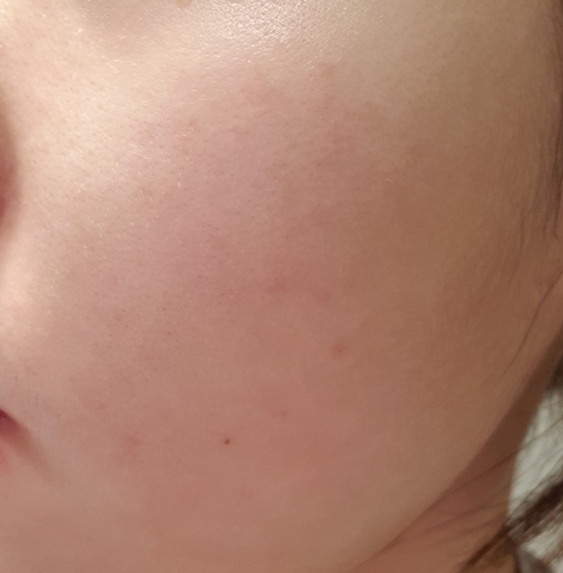 좀비뷰티 (ZOMBIEBEAUTY) 블러디 필 review image