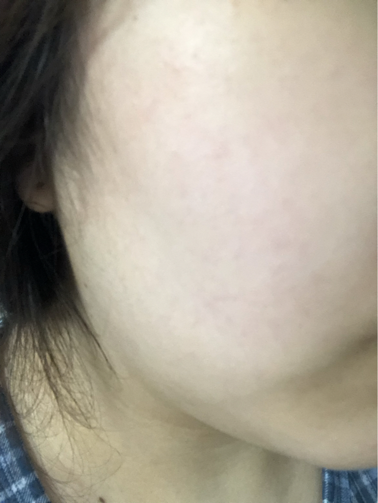 纯净舒缓精华的真实用户使用照片