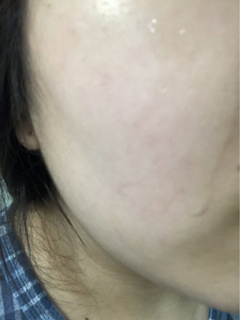 纯净舒缓精华的真实用户使用照片