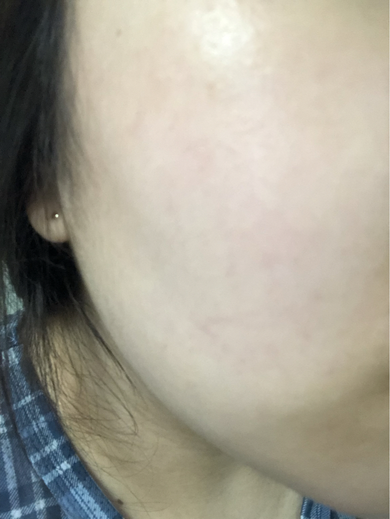 纯净舒缓精华的真实用户使用照片