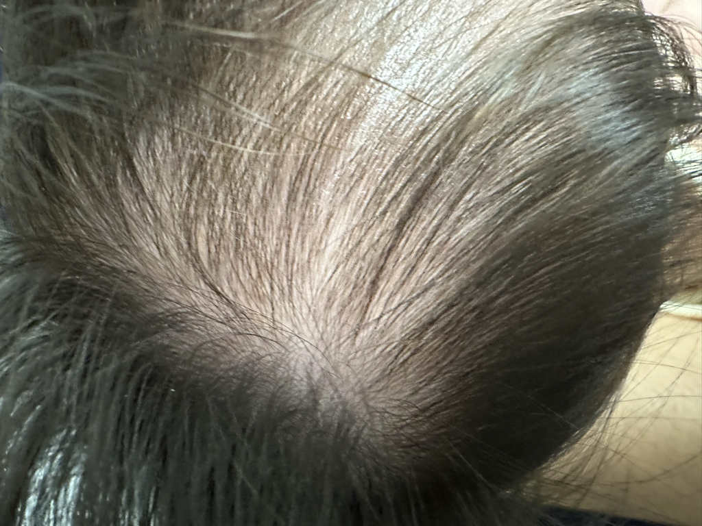 아이보들 (iBodle) 호호바100% 오일 review image