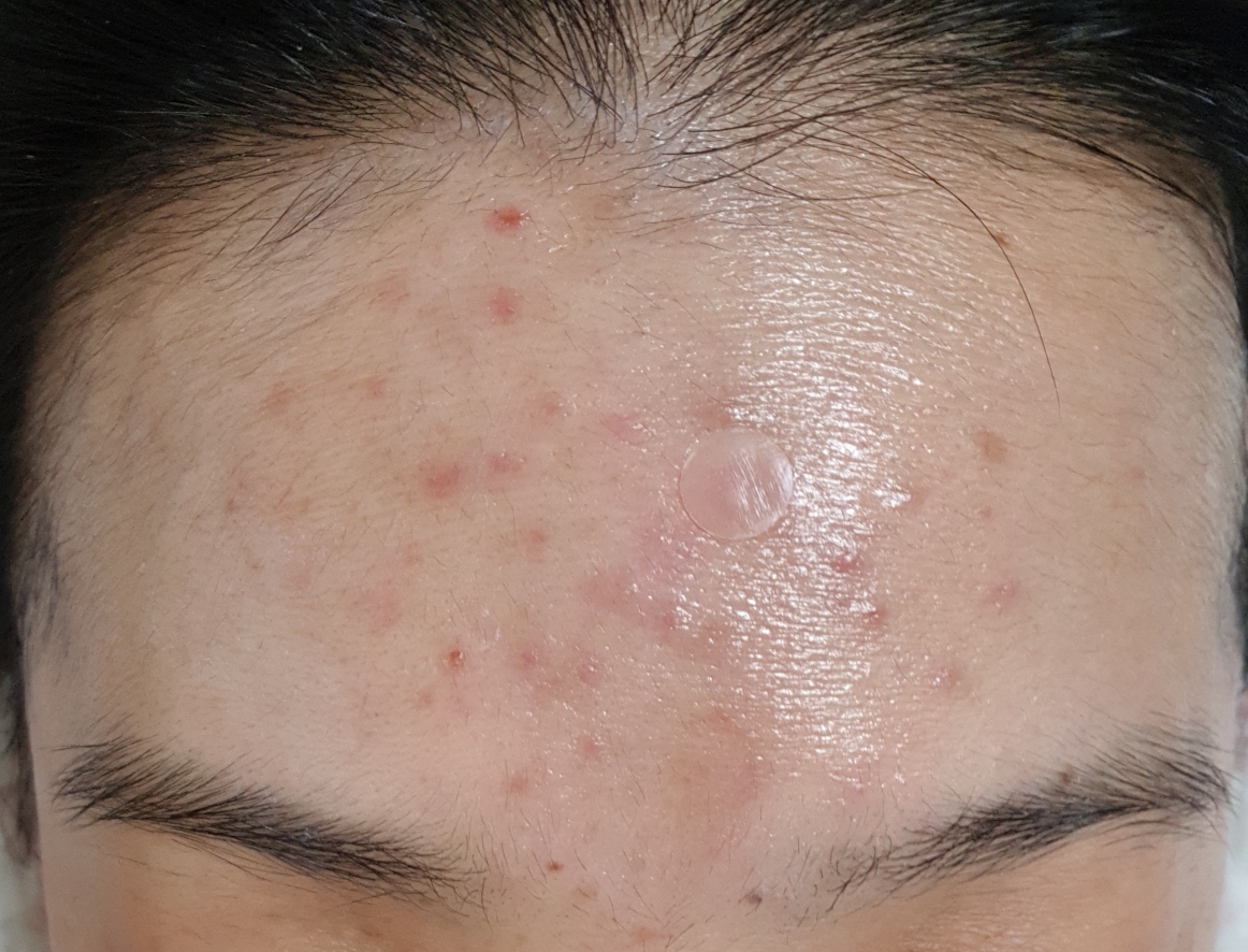 SOONNOC 水漾洁面棒 common.review image