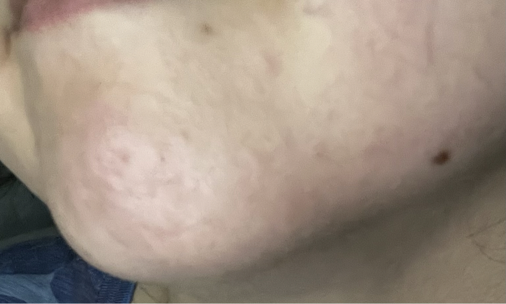 完美鞭打维生素C无孔发光的真实用户使用照片