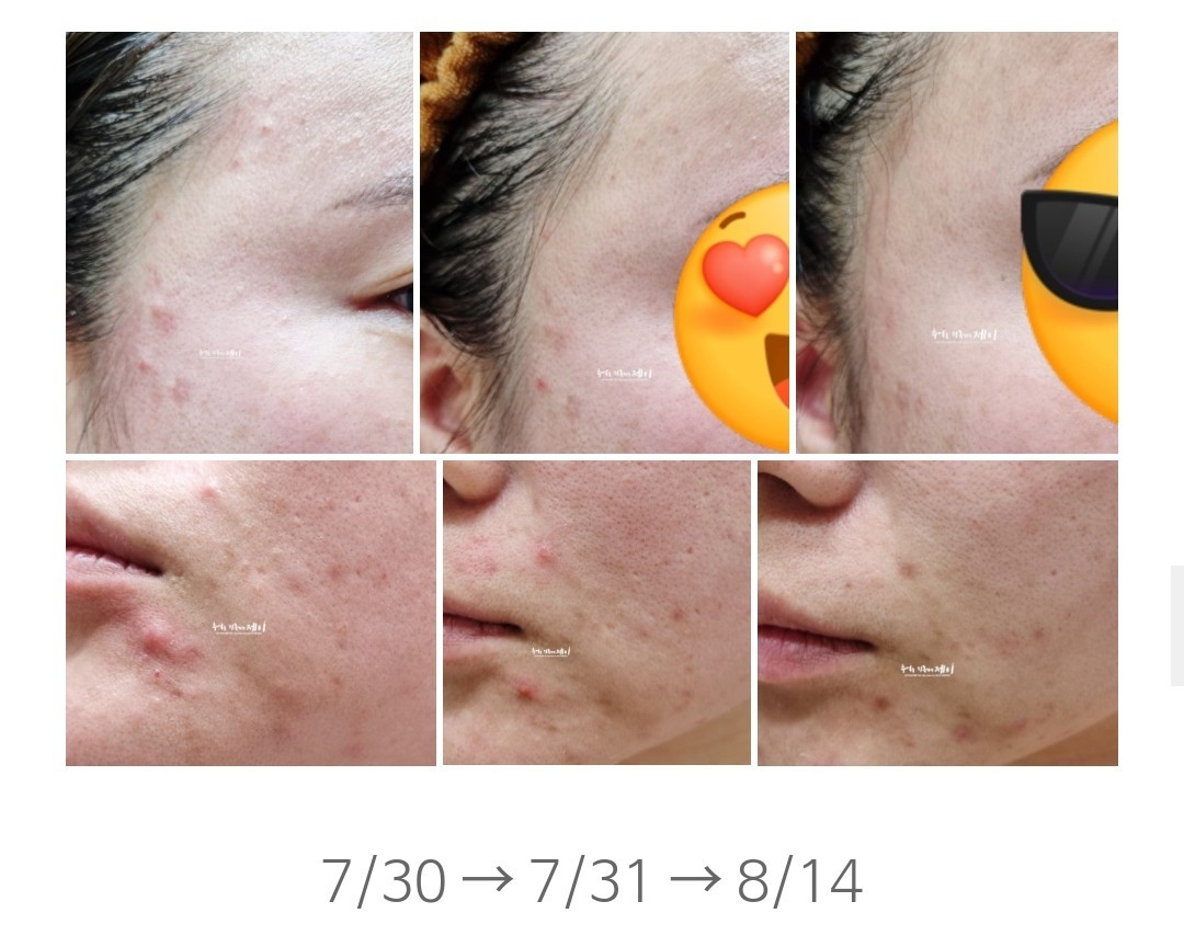 라루셀 (LALUCELL) 시카 리빌딩 세럼 review image