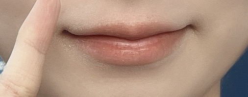 셀메드 (CellMed) 시아플렉스 밤 review image