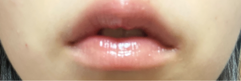 셀메드 (CellMed) 시아플렉스 밤 review image