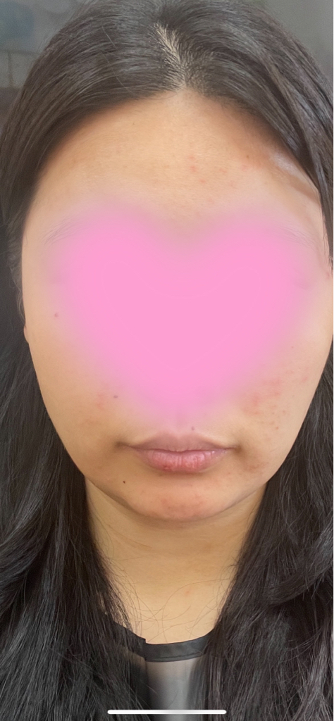 西卡伊德安普尔精华液的真实用户使用照片
