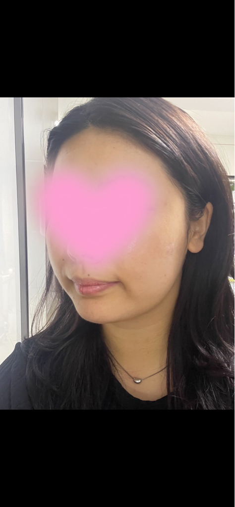 西卡伊德安普尔精华液的真实用户使用照片